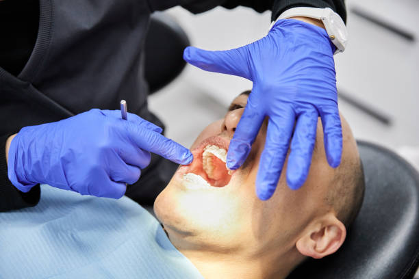 Best Root Canal Emergency Dentist  in Gordon, GA